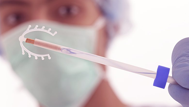 Ministério da Saúde volta a recomendar inserção de DIU pela Enfermagem